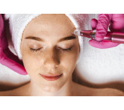 MESOTHERAPY